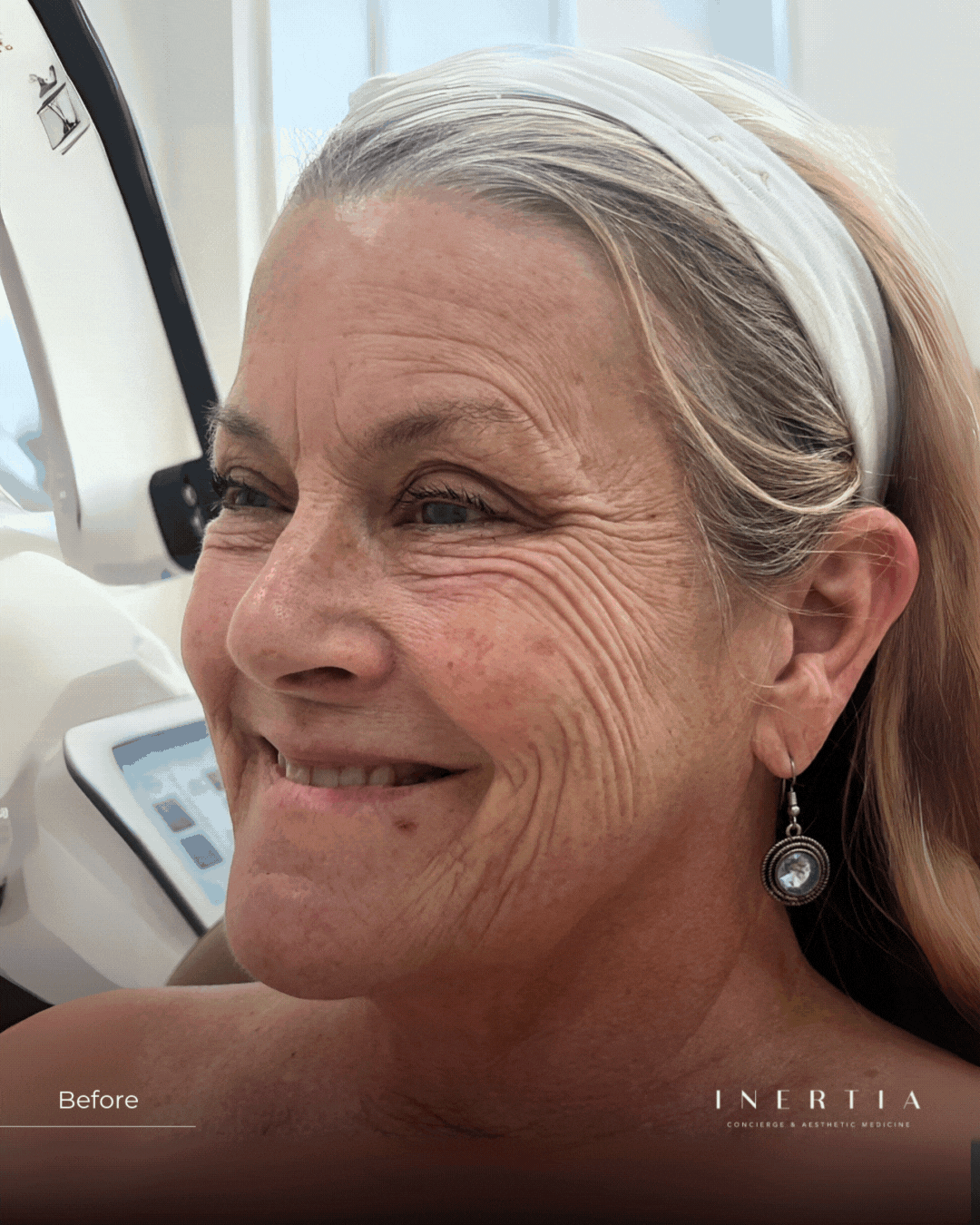 TRLINERTIATPA websiteB&A