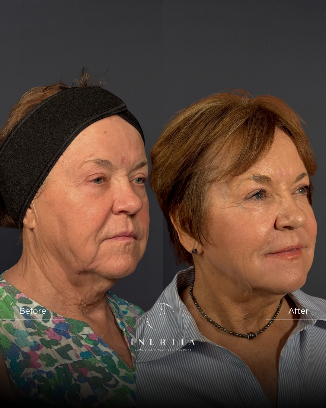 Side By Side TEMPLATE (3)