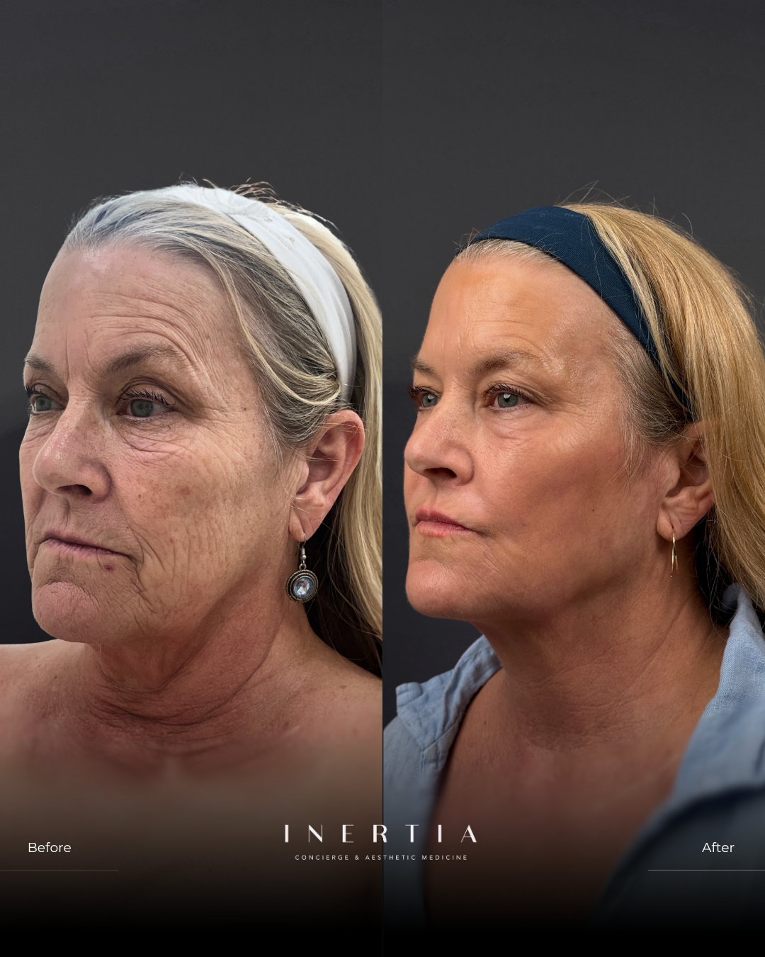 Side By Side TEMPLATE (4)