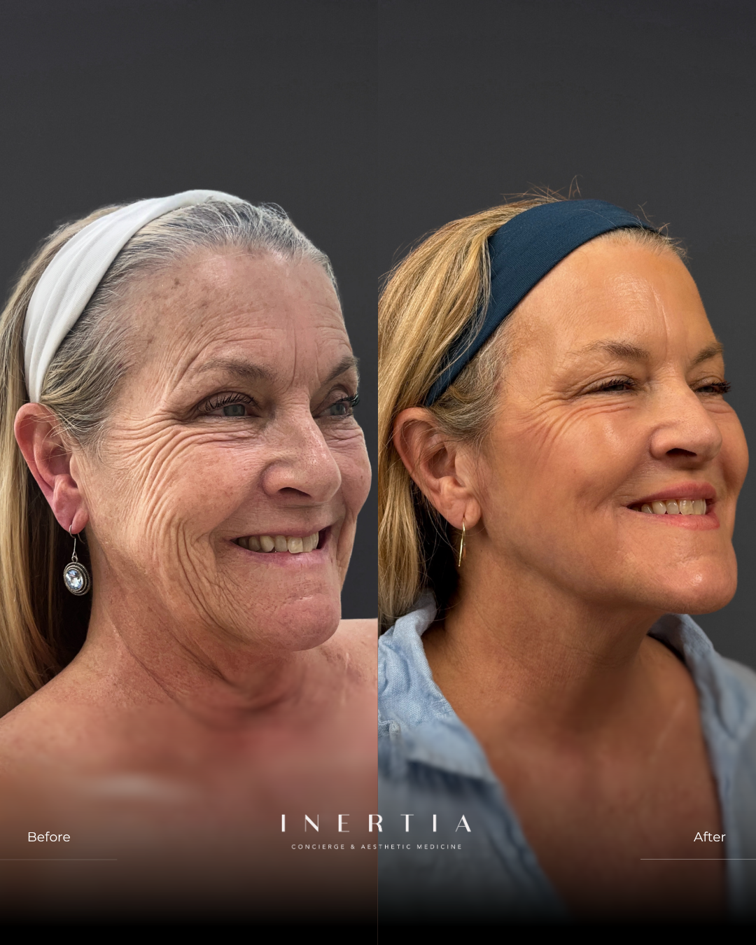 Side By Side TEMPLATE (6)