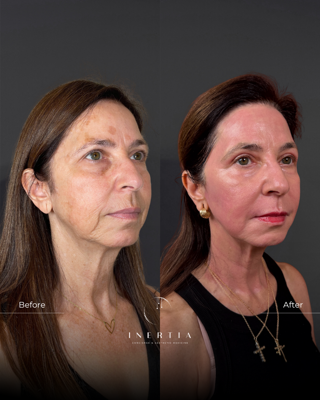 Side By Side TEMPLATE