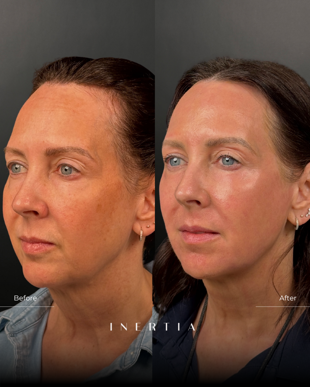 Side by Side Template