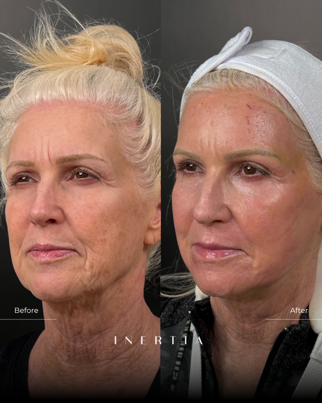 Side by Side Template (4)