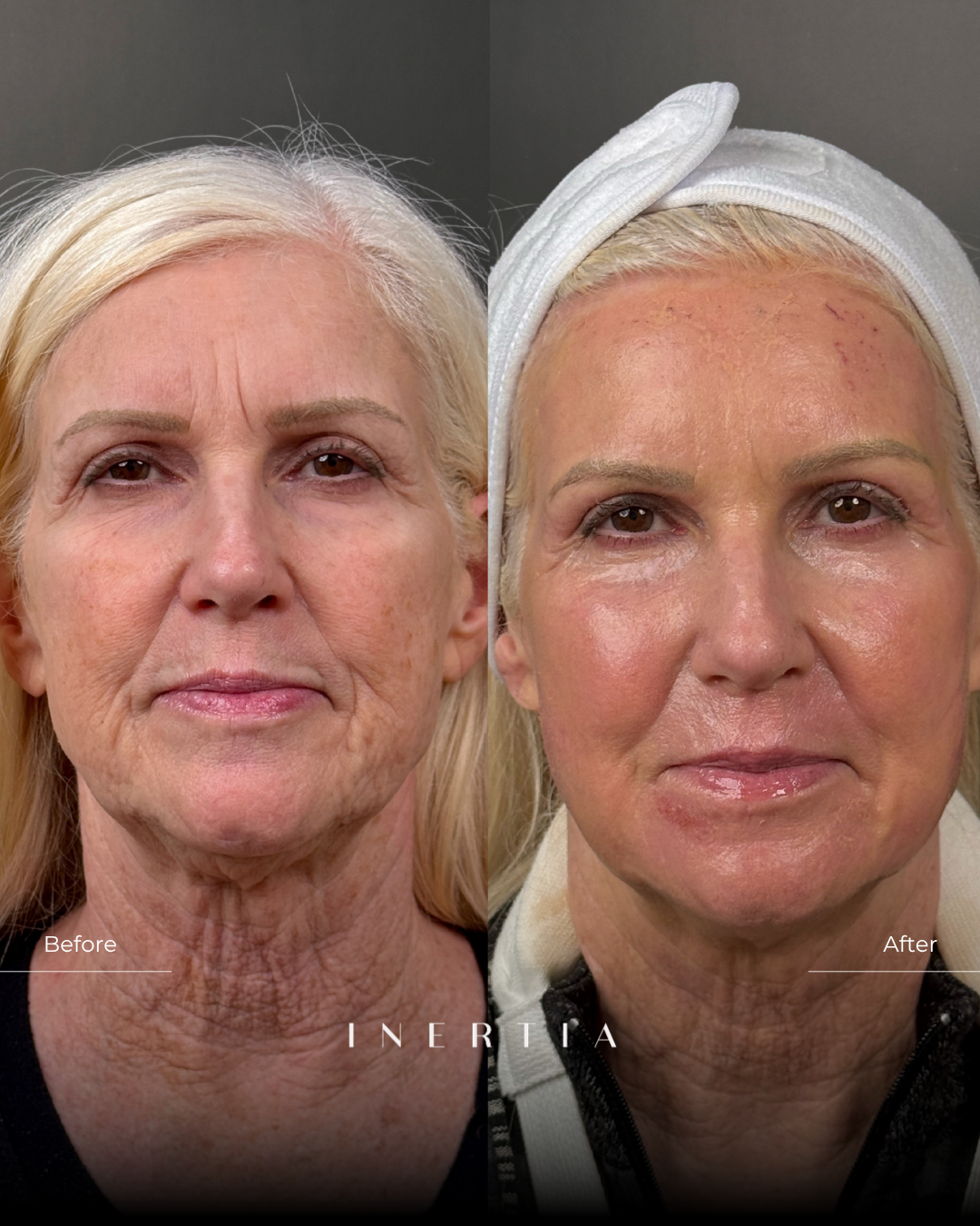 Side by Side Template (5)