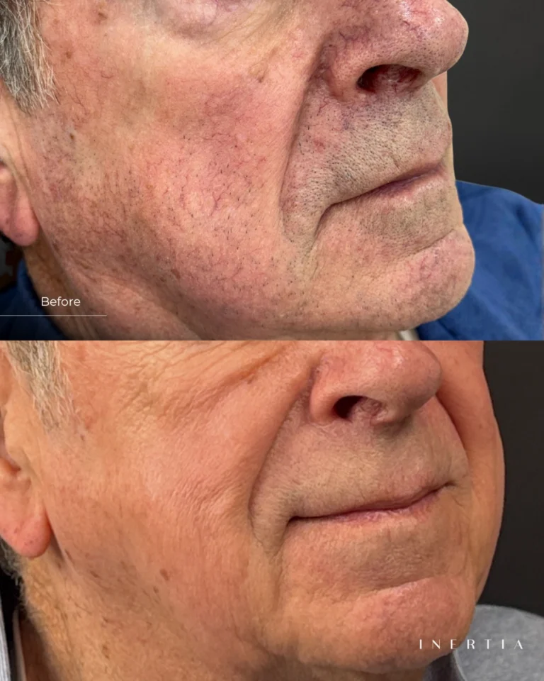 Instagram post from inertiatampa. This post is in position 2.