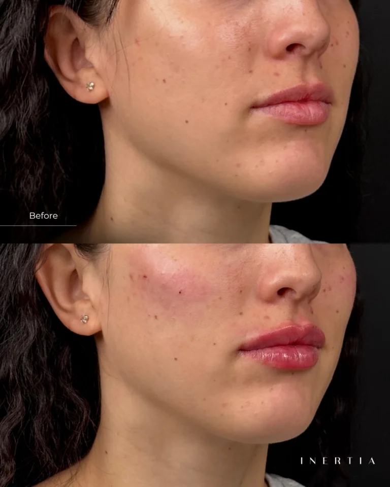 Instagram post from inertiatampa. This post is in position 2.