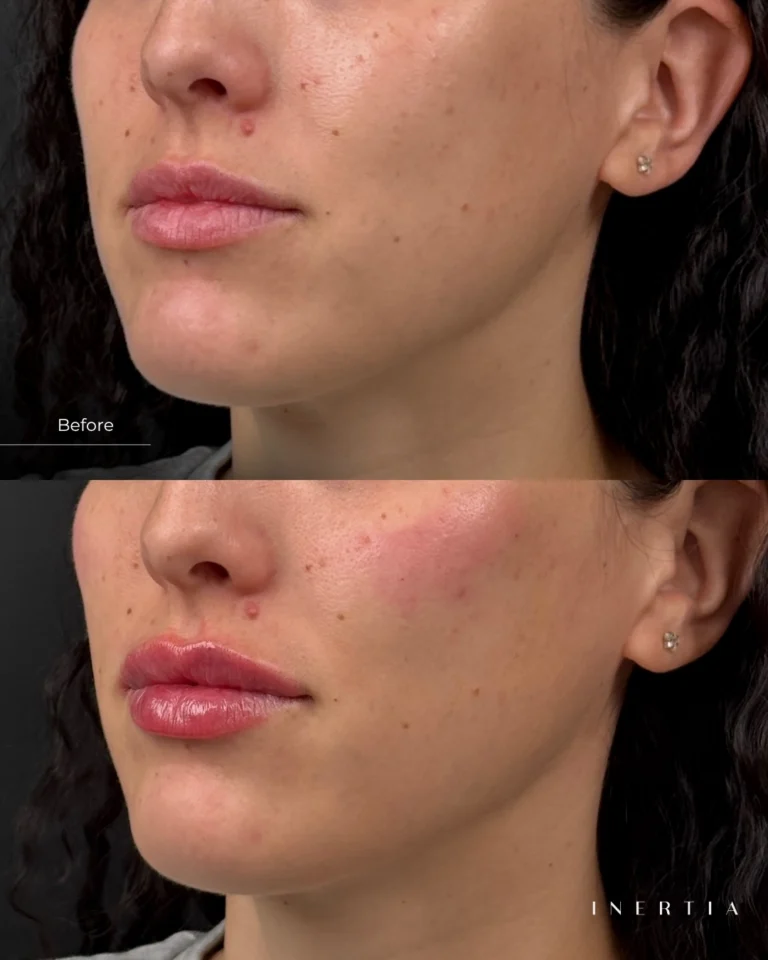 Instagram post from inertiatampa. This post is in position 0.